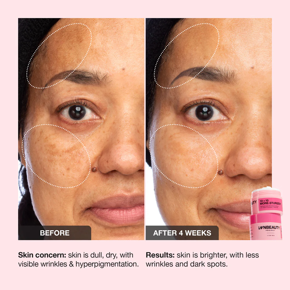 10+10 Daily Moisturizer - Image 4