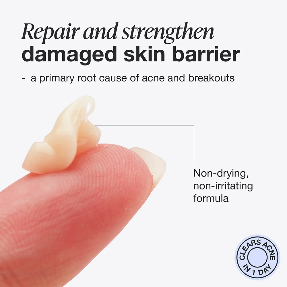 Acne Serum - Image 8