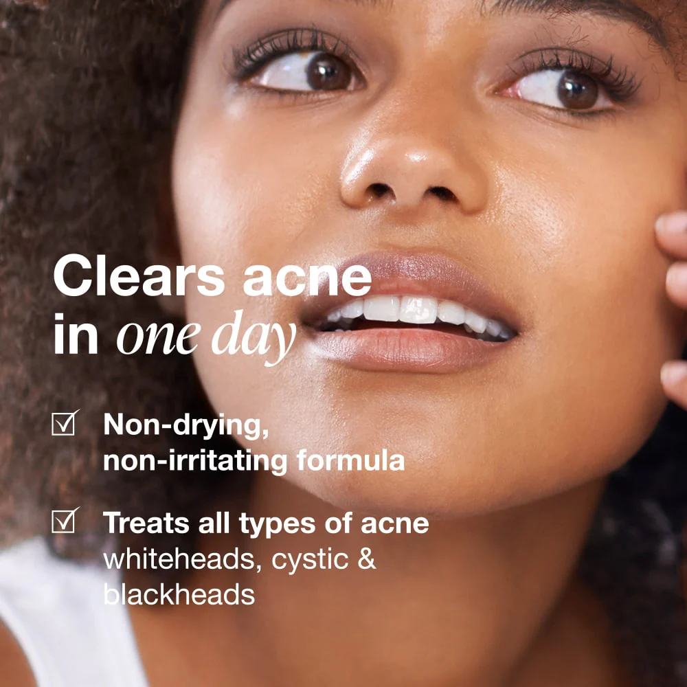 Acne Serum - Image 9