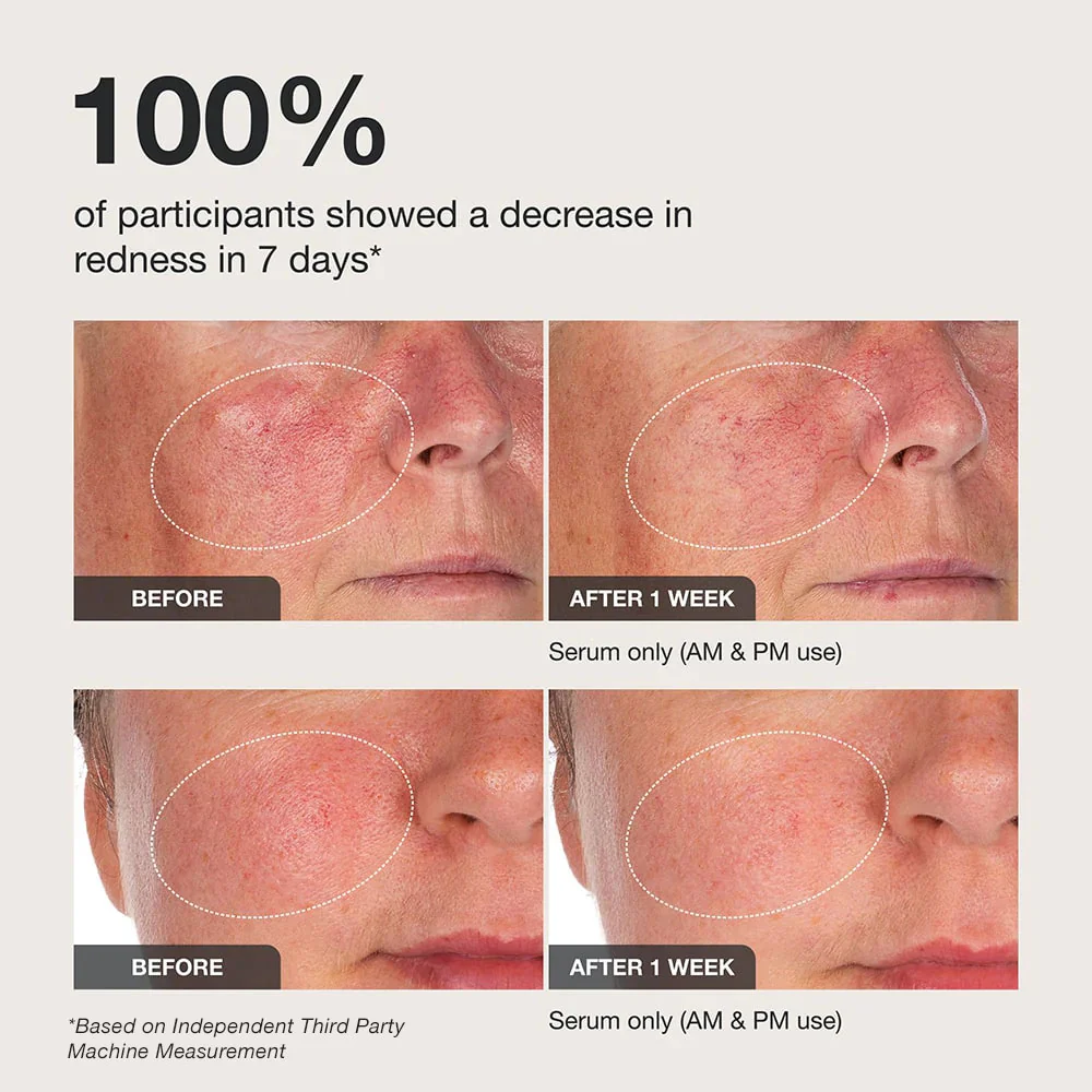 Calm The Red Down - Image 10