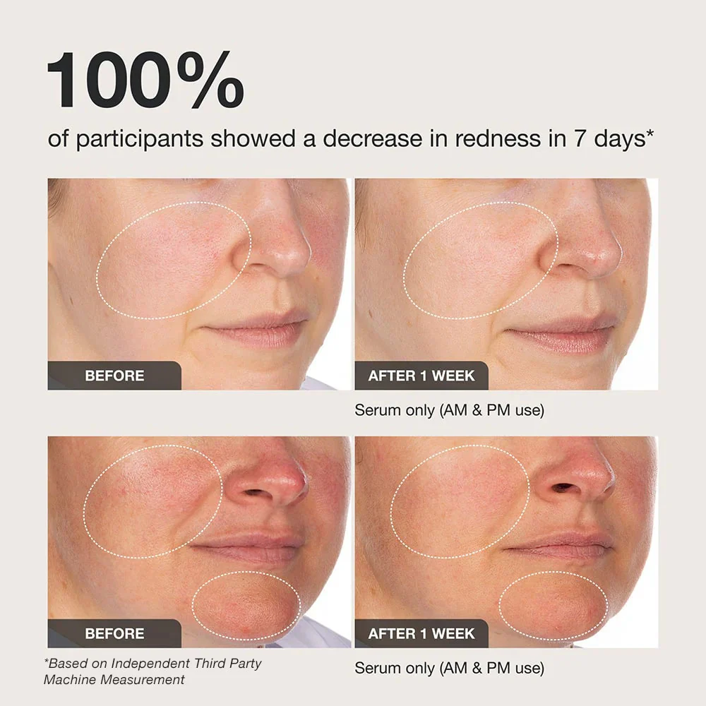 Calm The Red Down - Image 8