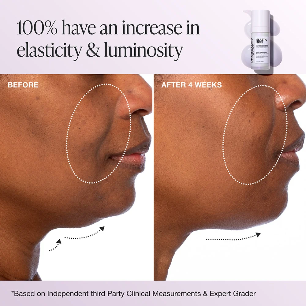 Elastic Skin - Image 4