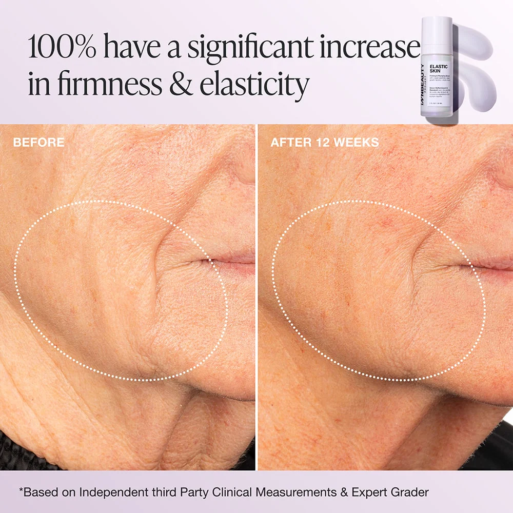 Elastic Skin - Image 5