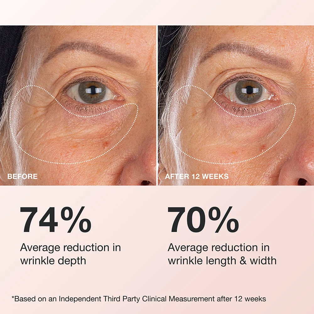 Extreme Cream Eye - Image 5