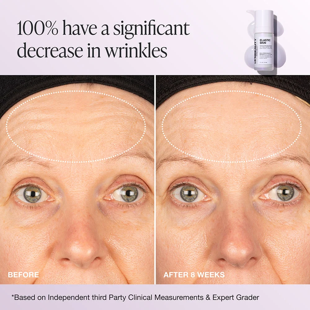 Elastic Skin - Image 3