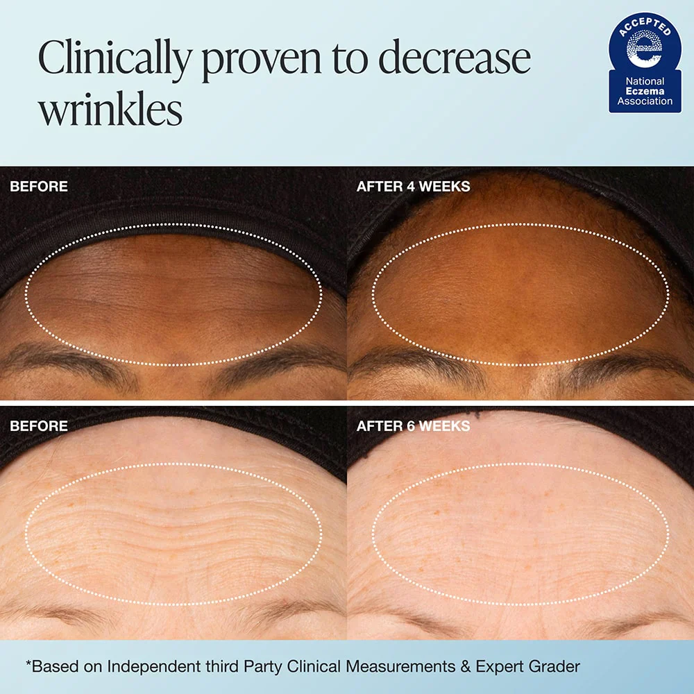 Recharge Refill Set - Image 4