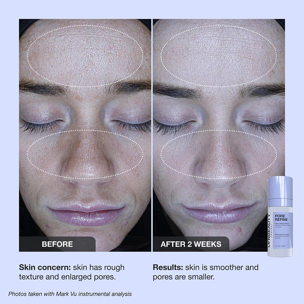 Pore Refine - Image 10