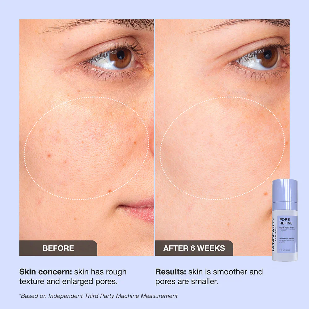 Pore Refine - Image 3