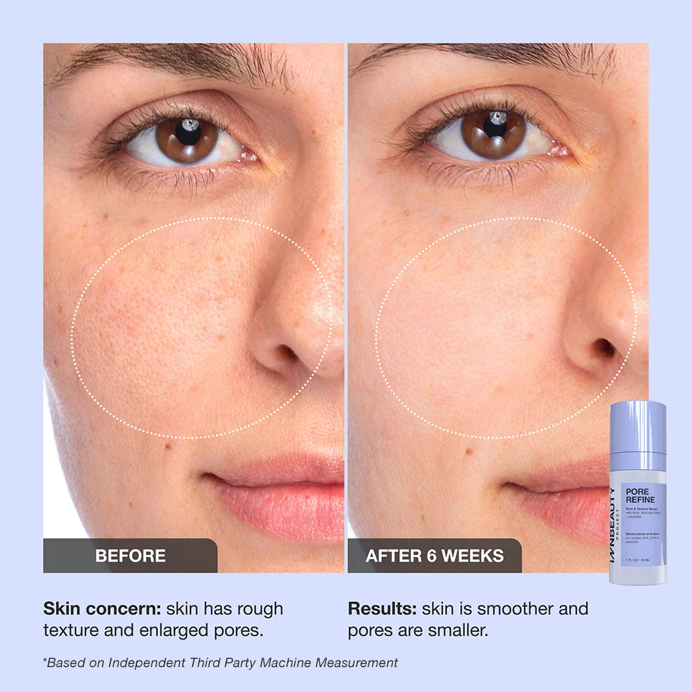 Pore Refine - Image 4