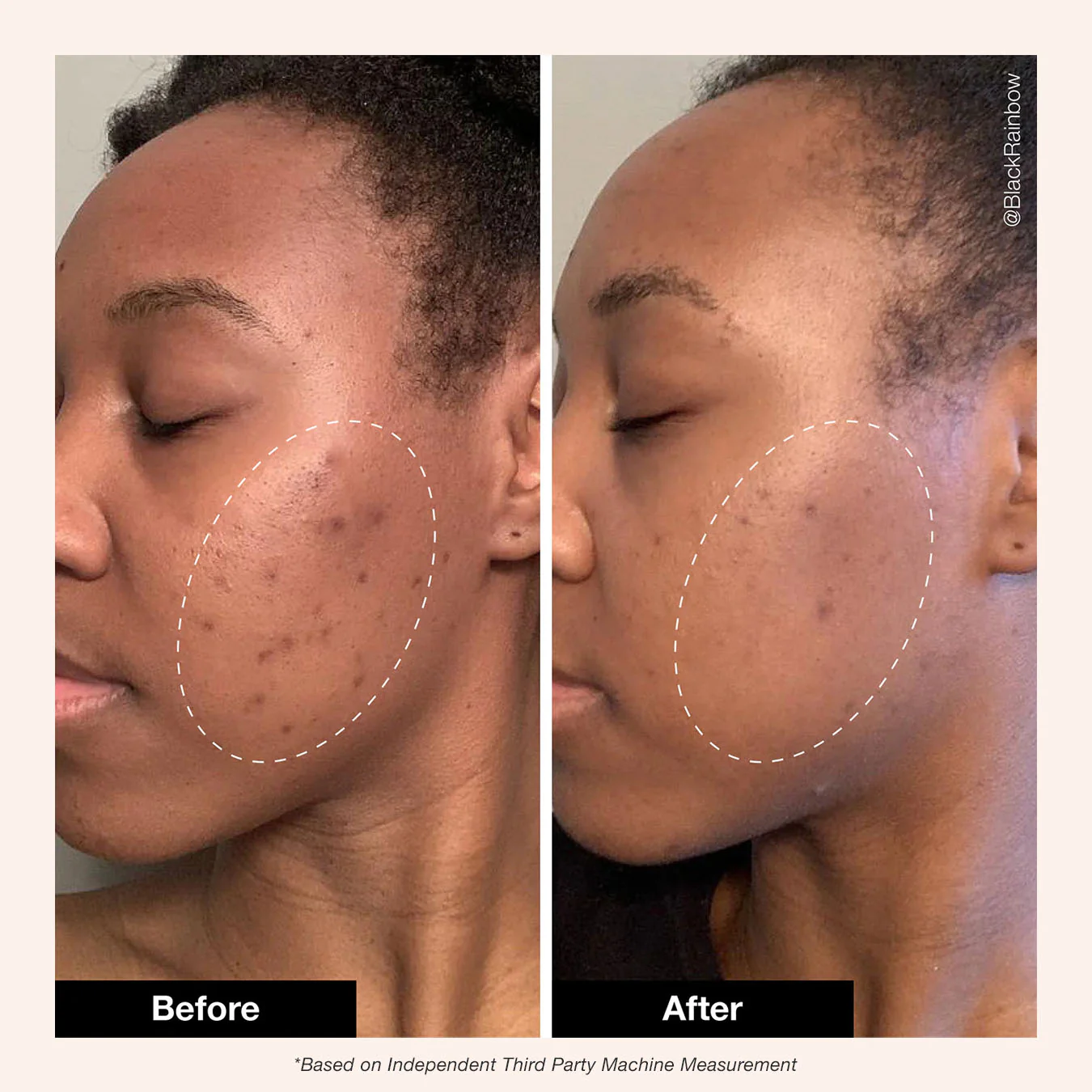 Retinol Remix 1% Retinol - Image 3