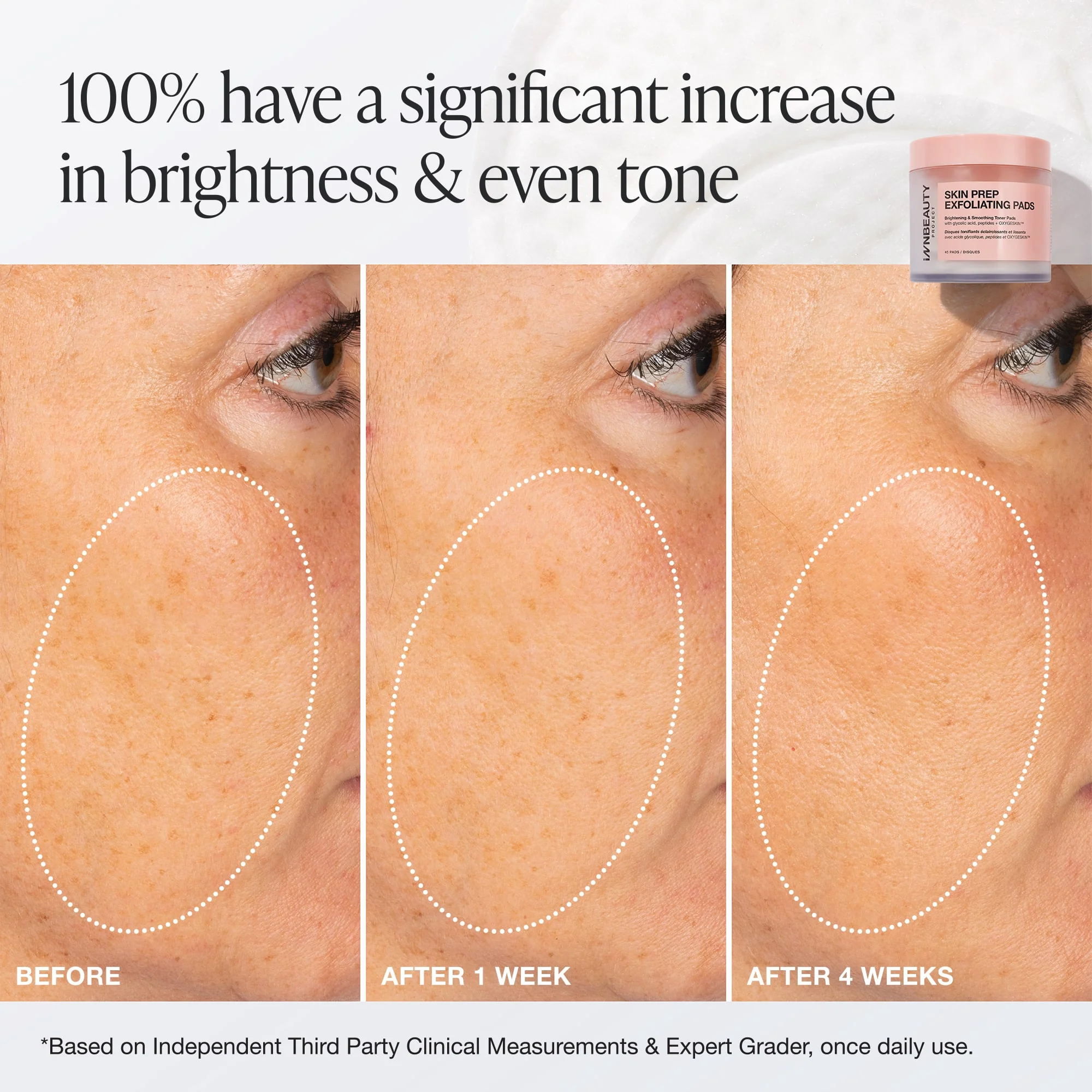 Skin Prep Exfoliating Pads - Image 3